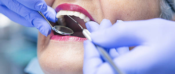Best Emergency Dentist for Knocked-Out Tooth in Sterling City, TX
